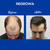 Regrowa Natural Hair Growth Serum
