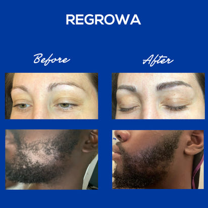 Regrowa Natural Hair Growth Serum