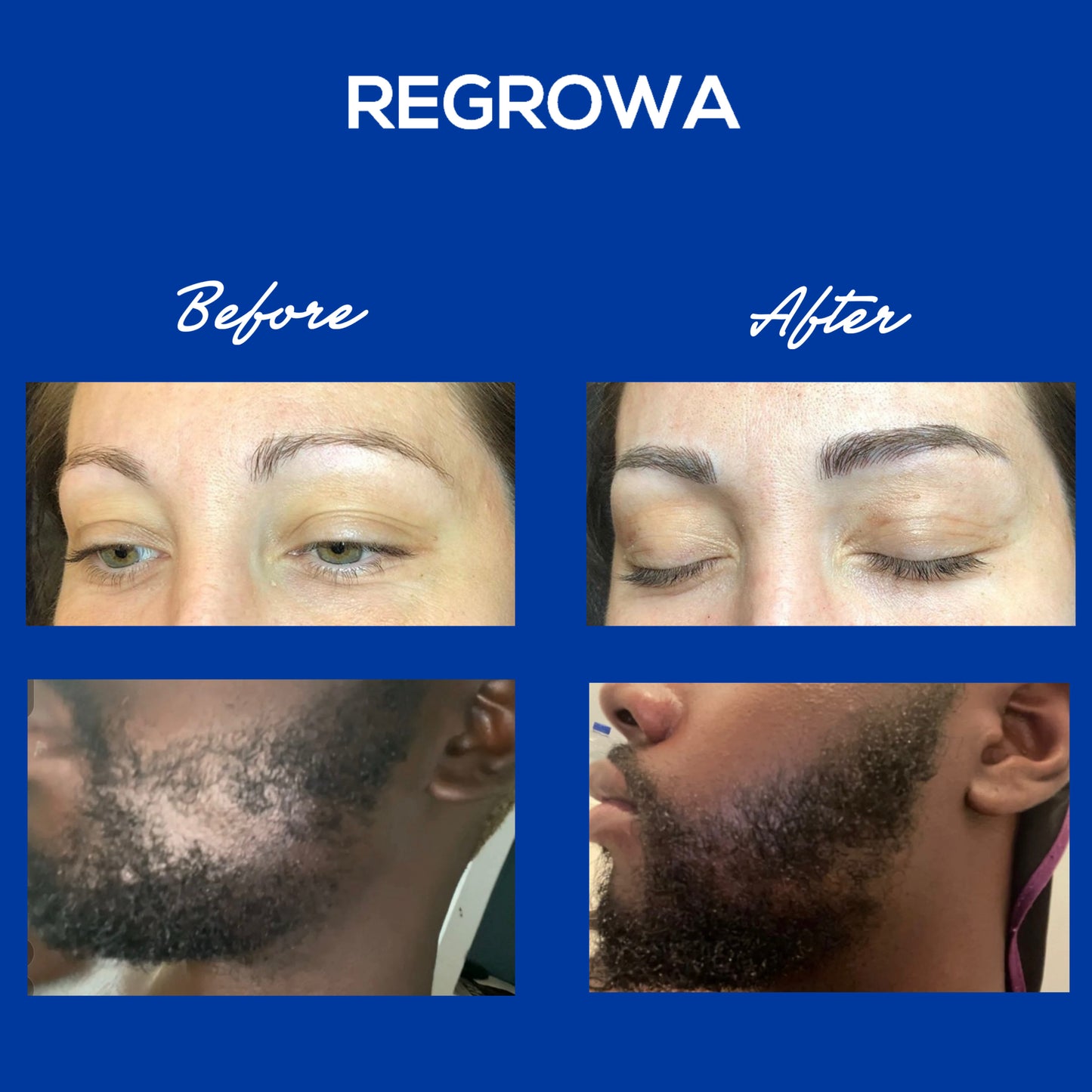 Regrowa Natural Hair Growth Serum