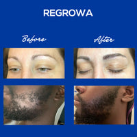 Regrowa Natural Hair Growth Serum